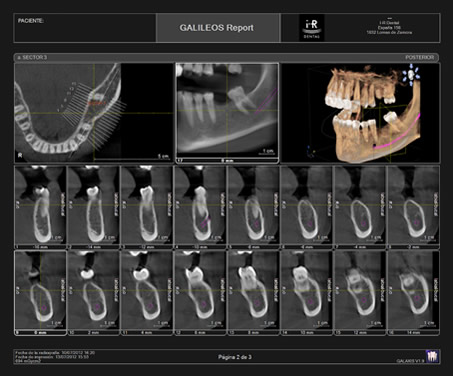 Implantologia dental