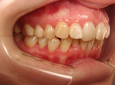 ortodoncia_3